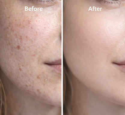 GHK-Cu Skin Renewal Serum